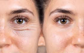 Eyelid Cosmetic and Reconstructive Surgery